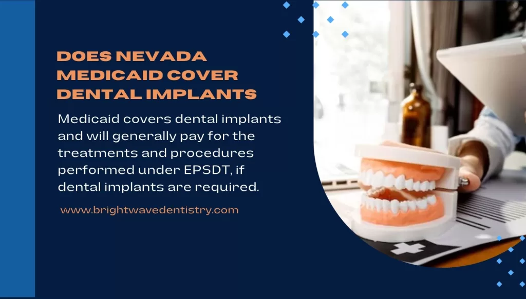 Does Nevada Medicaid cover dental implants