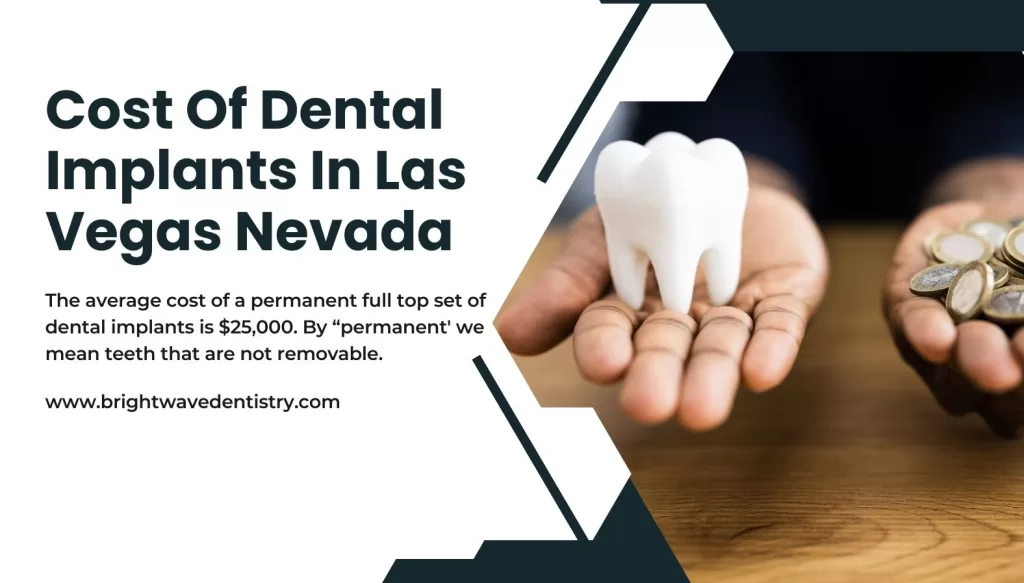 Cost of Dental Implants in Las Vegas Nevada