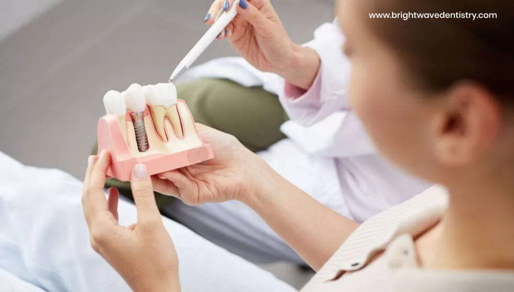 How much are dental implants in Las Vegas