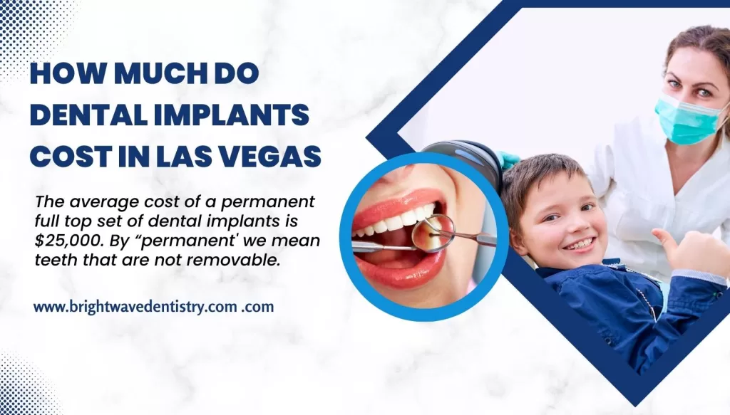 How much do dental implants cost in Las Vegas