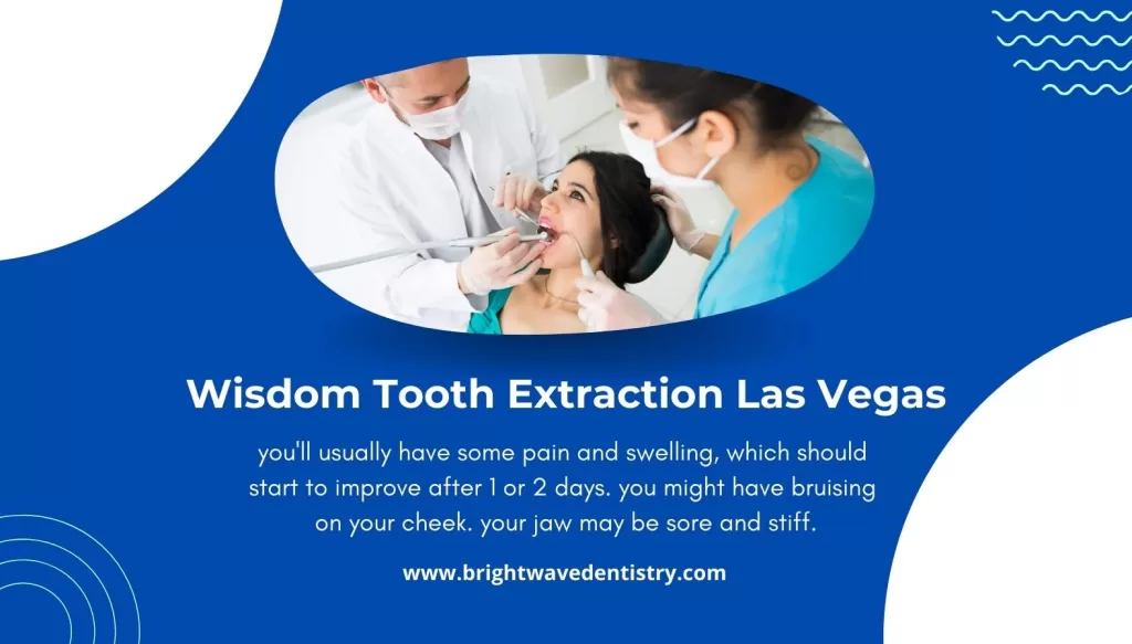 Wisdom Tooth Extraction Las Vegas